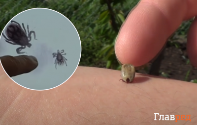 Укусил клещ: как правильно достать насекомое и не подхватить болезнь Лайма