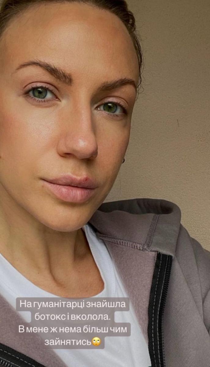 'На гуманитарке нашла ботокс и вколола': Леся Никитюк оправдалась за губы