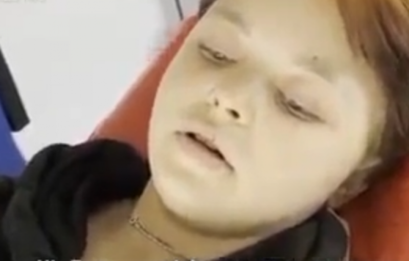 Проехала 30 км с простреленными ногами: 15 летняя Лиза спасла людей из Попасной