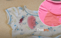Справа 20-ти хвилин: як і чим можна вивести плями від полуниці і вишні