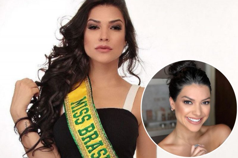 27-летняя Мисс Бразилия внезапно скончалась от элементарной операции