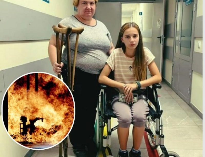 Осколок прошил бедро: на Донбассе девочка-подросток закрыла телом братика от обстрела