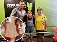 У США українкам, які втратили кінцівки через ракетний удар РФ по Краматорську, зробили протези