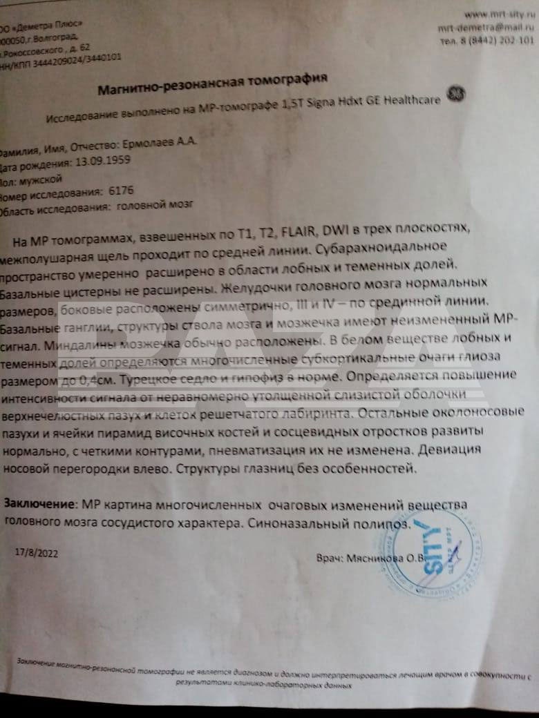 в РФ мобилизировали пенсионера с ишемией в РФ мобилизировали пенсионера с ишемией