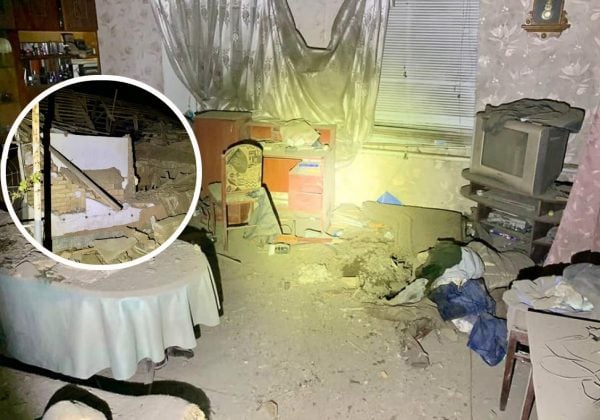 6-річна дівчинка втратила обидві ноги через обстріл окупантами Нікополя