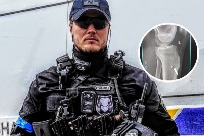 "Забинтував і поїхав на завдання": захисник України лише через місяць дізнався, що у нозі – куля окупантів