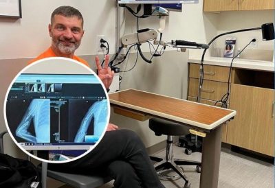 Дианов, операция