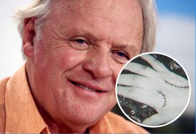 Хопкинс, Рука