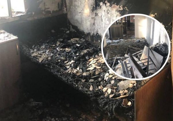 13-річний хлопчик двічі за добу потрапив під обстріл РФ, вдруге – у реанімації лікарні Херсону