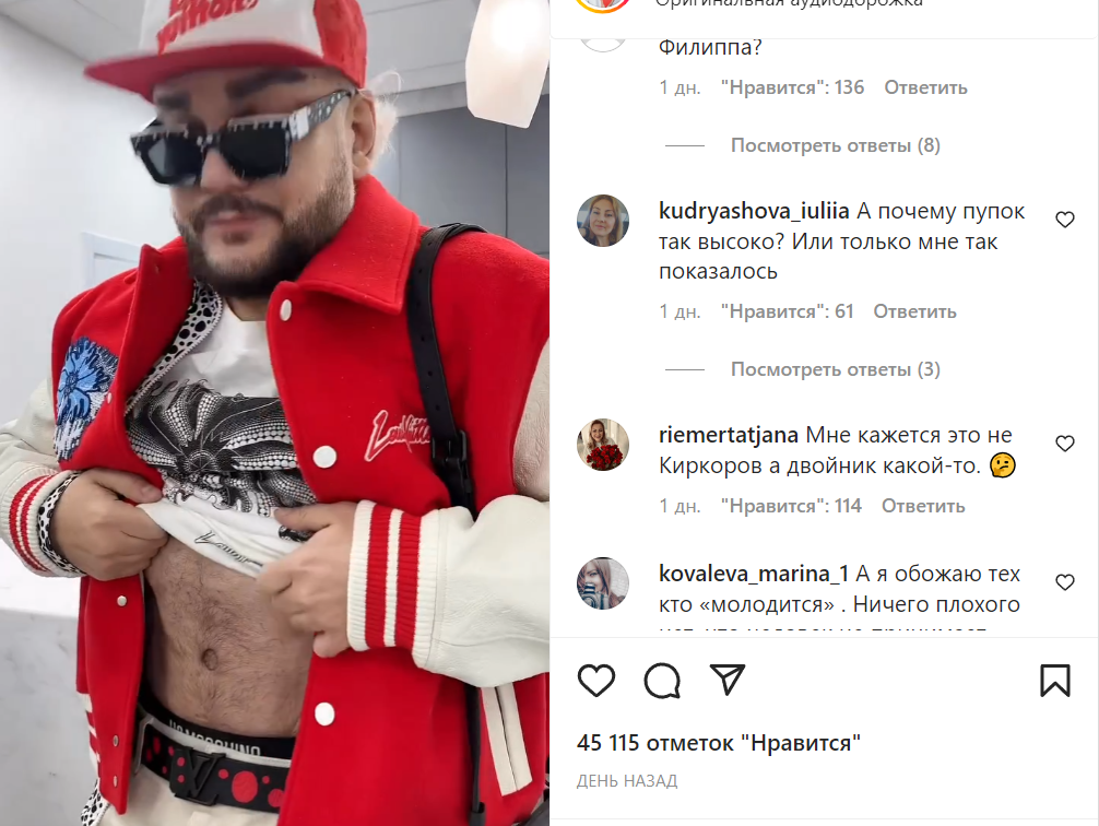 Киркоров показал последствия пластики Киркоров показал последствия пластики