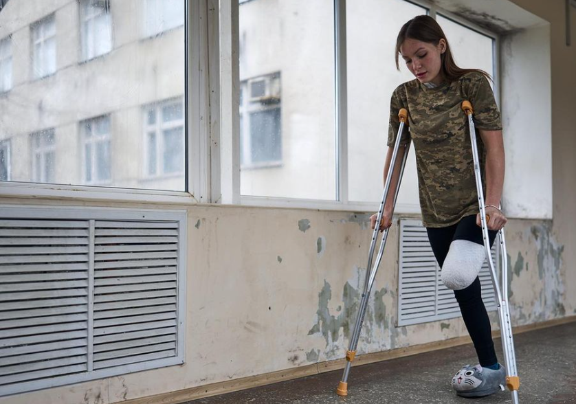 Девушка потеряла ногу после российского обстрела Девушка потеряла ногу после российского обстрела