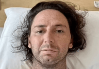 Чхнув і став інвалідом: чоловіка паралізувало після того, як він просто висякався