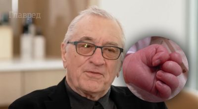 Де Ніро, дитяча рука Де Ніро, дитяча рука