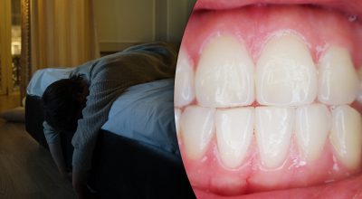 Почему скрипят зубами во сне Почему скрипят зубами во сне