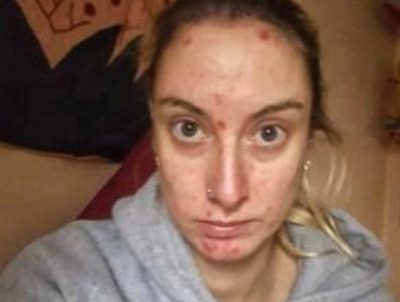 Дівчина змінилася до невпізнання без алкоголю Дівчина змінилася до невпізнання без алкоголю