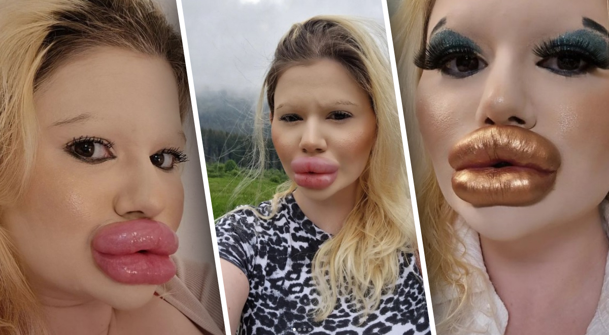 Блогерка перетворила обличчя на 'надувну подушку': шукає гроші на 'скули' Блогерка перетворила обличчя на 'надувну подушку': шукає гроші на 'скули'