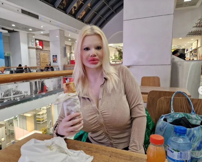 Блогерка перетворила обличчя на 'надувну подушку': шукає гроші на 'скули' Блогерка перетворила обличчя на 'надувну подушку': шукає гроші на 'скули'