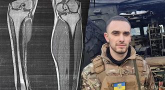 "Отрежь ногу - получишь группу": военному отказались давать 2 группу инвалидности