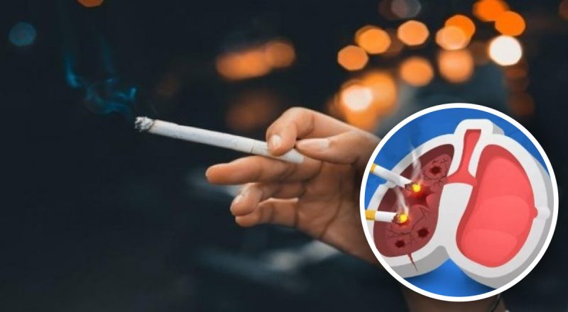 Какие на самом деле легкие курильщика: несложная информация удивят результатом