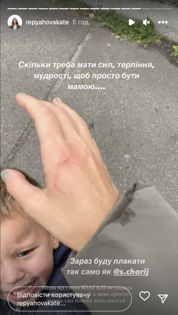 Репяхова укусил собственный сын Репяхова укусил собственный сын
