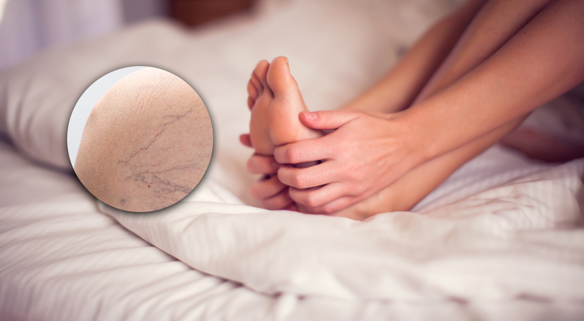 Ночные судороги в ногах: причины возникновения и лечение. Как избавиться от судорог в ногах?
