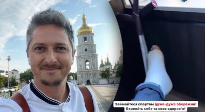 Популярний український телеведучий отримав травму і з'явився на милицях: що сталося Популярний український телеведучий отримав травму і з'явився на милицях: що сталося