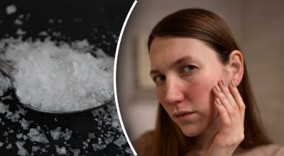 Лікарка розкрила секрет: що допоможе зняти набряки обличчя - результати вразять жінок Лікарка розкрила секрет: що допоможе зняти набряки обличчя - результати вразять жінок