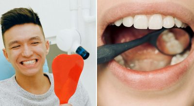 Чорні трикутники між зубами: стоматолог попередив про загрозу для кожного Чорні трикутники між зубами: стоматолог попередив про загрозу для кожного