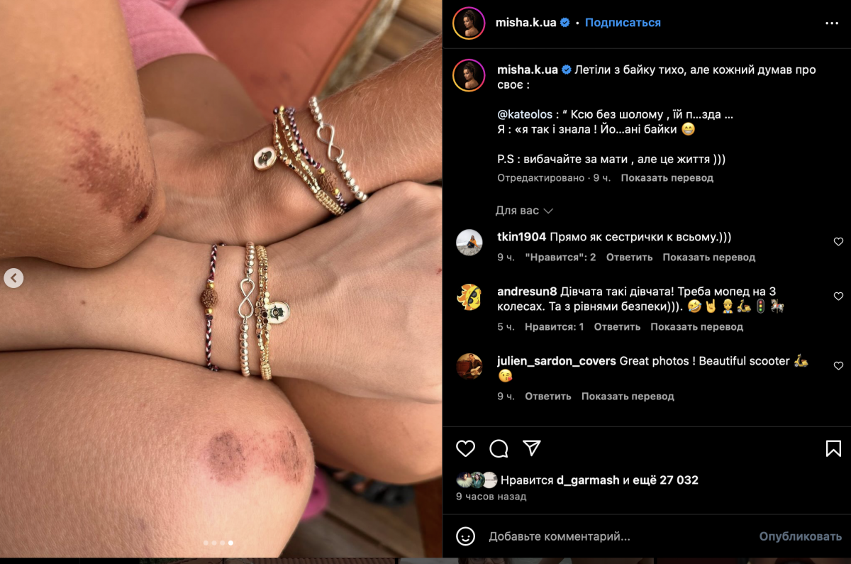 Ксенія Мішина отримала травми на відпочинку Ксенія Мішина отримала травми на відпочинку