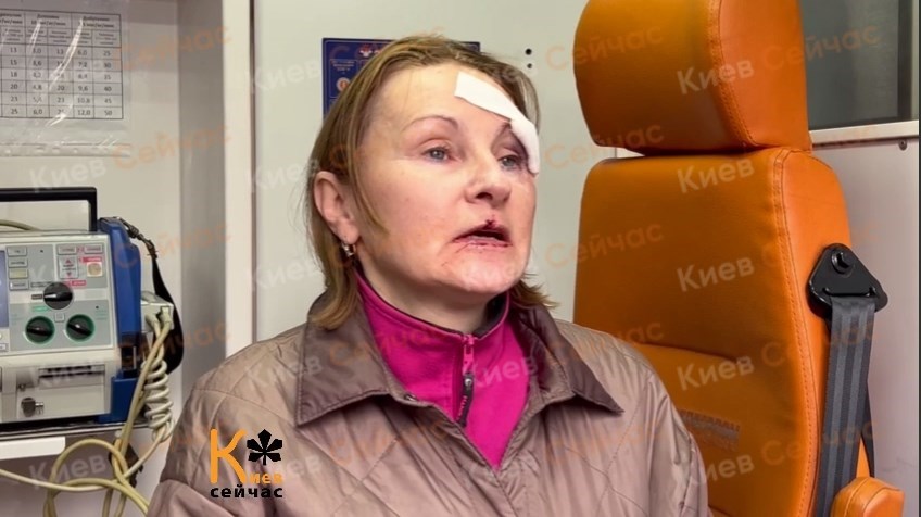 Киев, пострадавшие