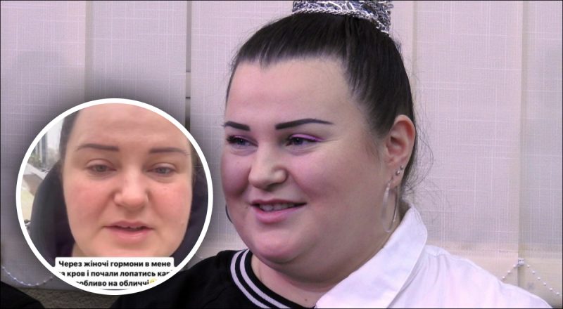 Alyona Alyona пожаловалась фанатам на новые проблемы со здоровьем