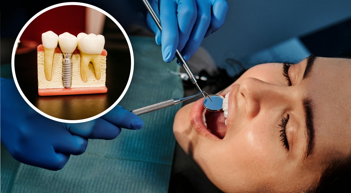 Зачем врач ставит временную пломбу: стоматолог раскрыл, что происходит с зубом