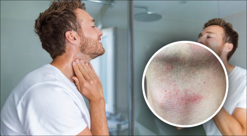 Как быстро снять раздражение после бритья: простые трюки помогут справиться