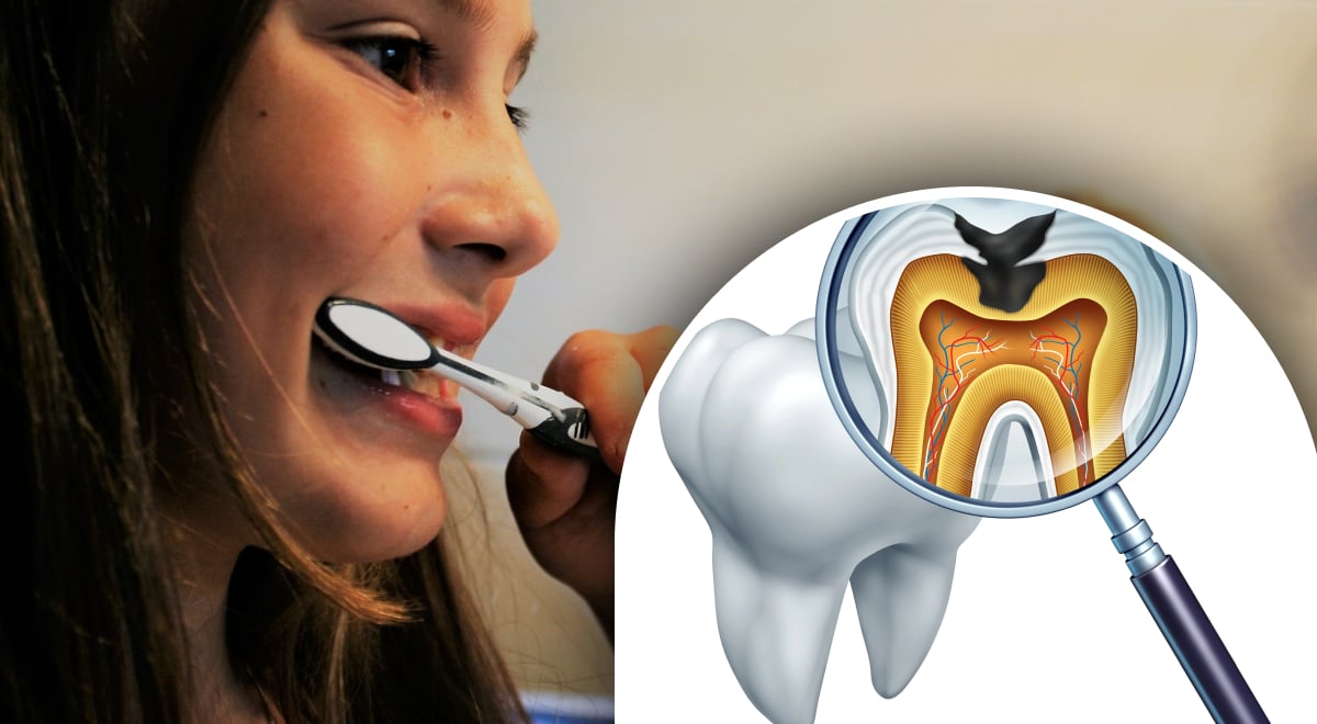 Что на самом деле происходит с зубом без нервов: стоматологи ошеломили ответом