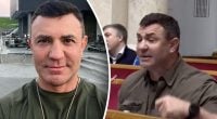 Что с лицом Тищенко? Раскрыто, какие пластические процедуры делает депутат