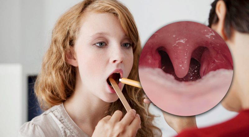 Видели все, но назначение знают единицы: для чего нужен "язычок" в горле