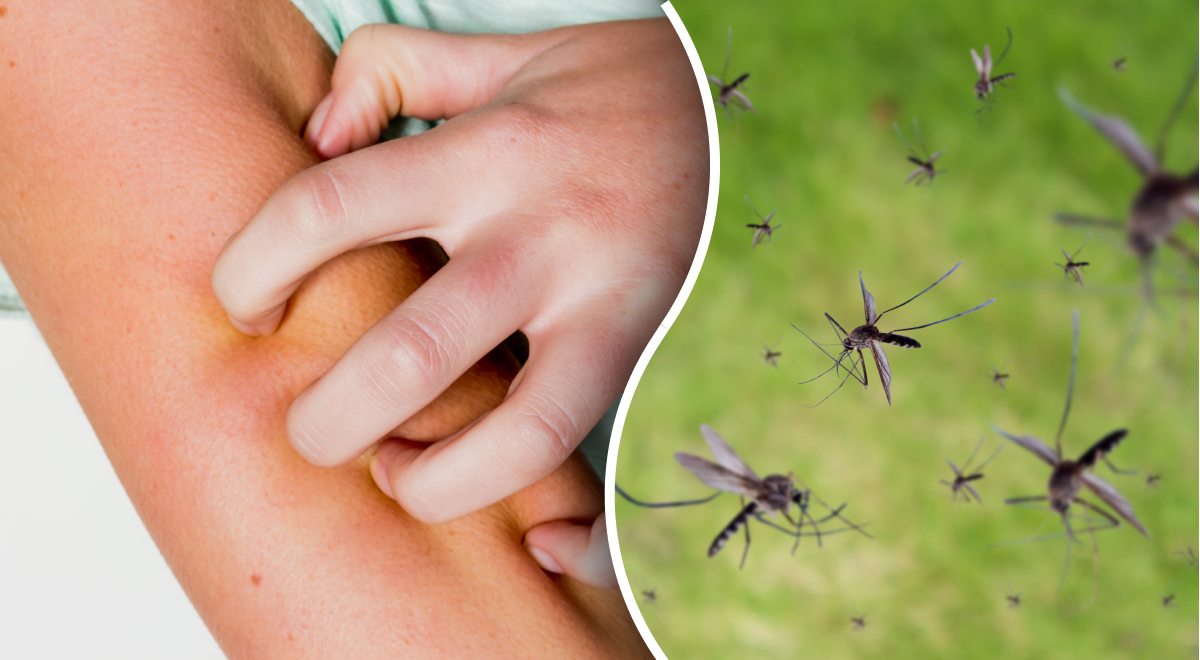 Магнит для насекомых: кого чаще всего кусают комары - простое объяснение