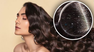 Жінка використовує незвичайний продукт для лікування лупи: волосся блискуче та здорове Жінка використовує незвичайний продукт для лікування лупи: волосся блискуче та здорове