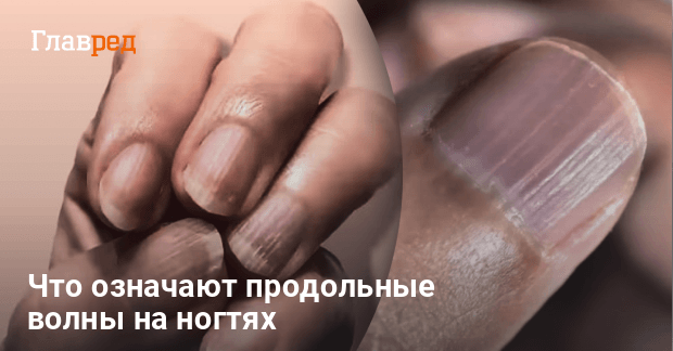 Неровные ногти: почему на них появляются точки, бугорки и бороздки