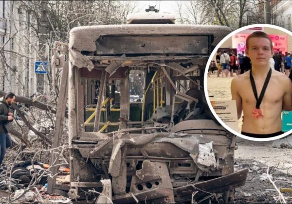 У Сумах 13-річний школяр з пораненням врятував пасажирів з палаючого автобуса