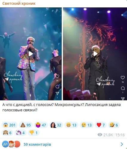 Філіп Кіркоров на концерті Філіп Кіркоров на концерті