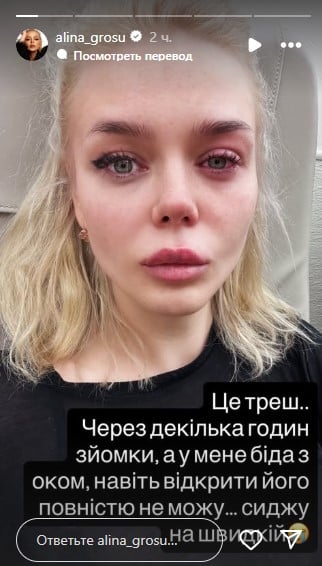 В Аліни Гросу проблеми зі здоров'ям В Аліни Гросу проблеми зі здоров'ям