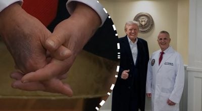 Трамп, врач, синяки, синяк Трамп, врач, синяки, синяк