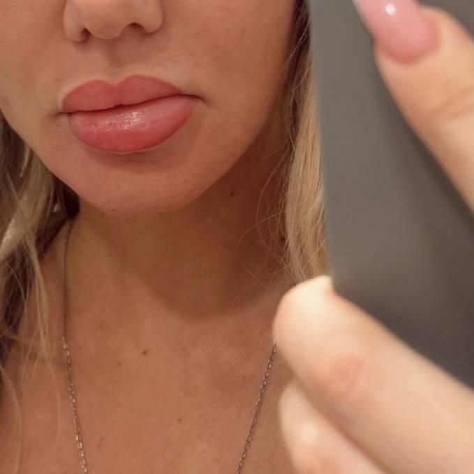 Сєдокова та її губи 