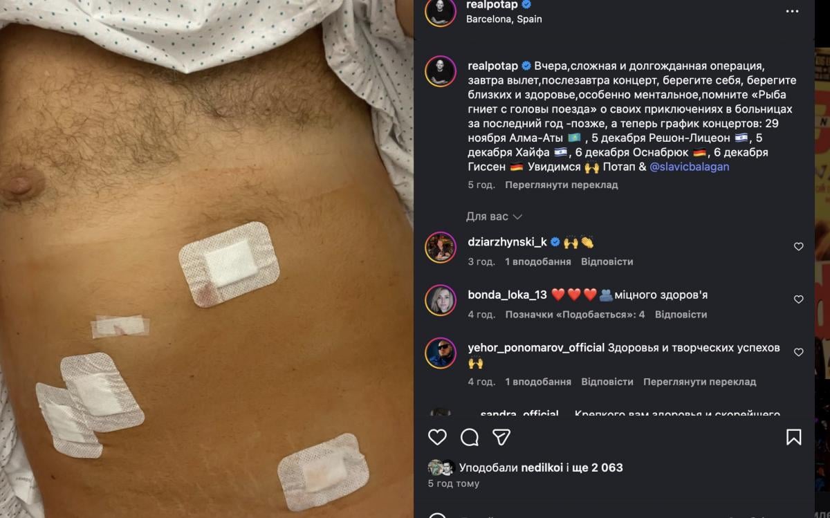 Потап повідомив про операцію 