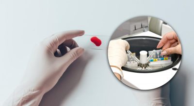 Имеет менее 1% людей: какая самая редкая группа крови в мире