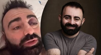 Зірка "Скаженого весілля" опинився в лікарні з травмою черепа