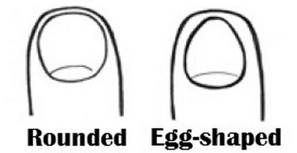 Ногти круглой и овальной формы Ногти круглой и овальной формы