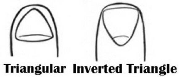 Треугольные ногти Треугольные ногти