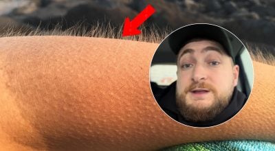 Вираз "мурашки по шкірі" можна забути: існує цікавіший український варіант